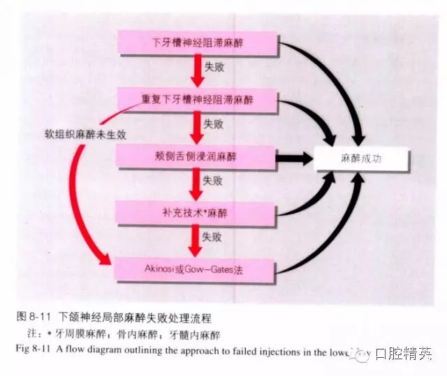 分析局部麻醉失敗的常見原因