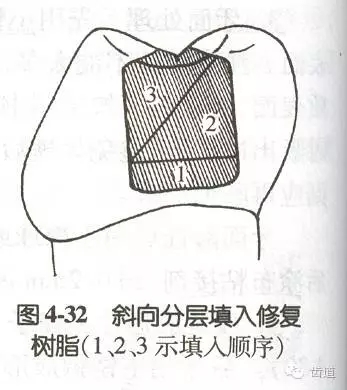 黏結修復的九大操作程序及九大失敗原因