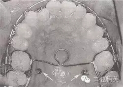 口腔醫(yī)學主治醫(yī)師筆試-精講強化-齲病牙體硬組織牙髓病和根尖周