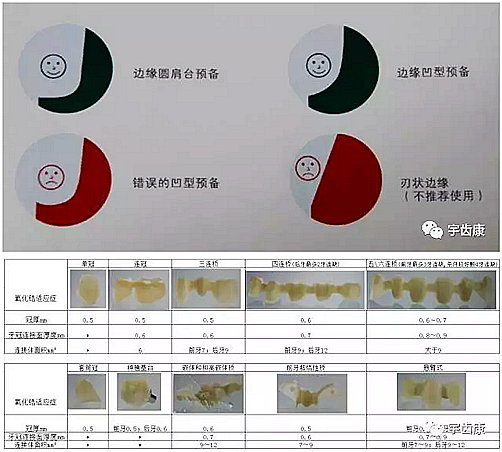 影響全瓷牙冠裂的因素有哪些？