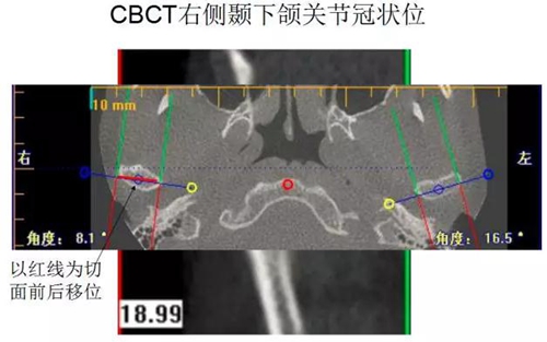 	口腔修復(fù)治療中，常見臨床接診流程