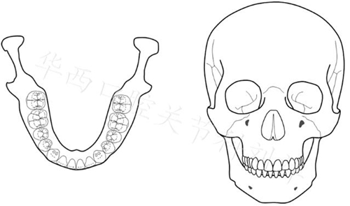 口腔材料對(duì)MRI檢查的影像到底有多大？  