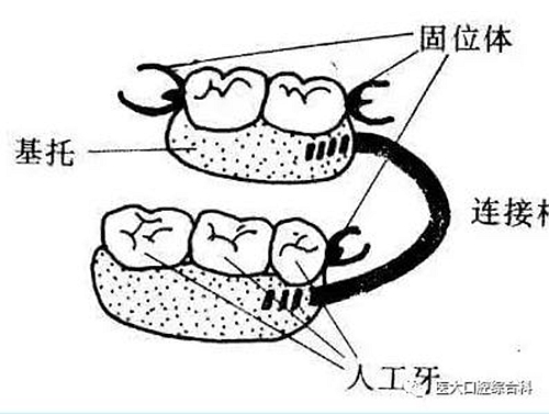 醫(yī)大口腔綜合科 |“鑲牙”的學(xué)問——活動類 