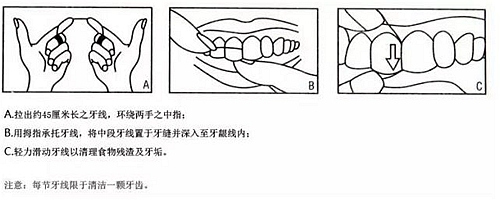 牙周病患者的外提升 梁光強