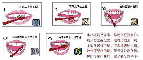 牙周病患者的外提升 梁光強