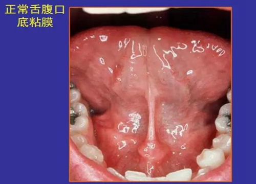 正?？谇火つぜ俺Ｒ姴p圖