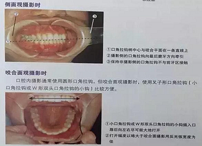 口腔攝影方法與技巧