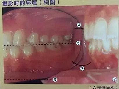 口腔攝影方法與技巧