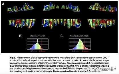 正畸文獻閱讀--正畸過程中牙根移動的三維監(jiān)測