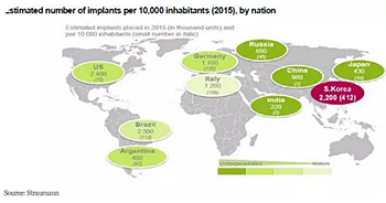 種植體，在全球牙科設(shè)備市場(chǎng)的變化！