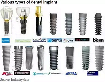 種植體，在全球牙科設(shè)備市場(chǎng)的變化！