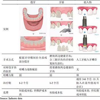 種植體，在全球牙科設(shè)備市場(chǎng)的變化！