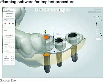 種植體，在全球牙科設(shè)備市場(chǎng)的變化！