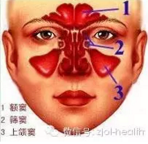 拔牙后引出“偏頭痛”！這種情況絕不能置之不理！