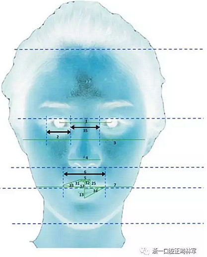 正畸文獻(xiàn)閱讀--對美貌年輕女性面部尺寸的分析