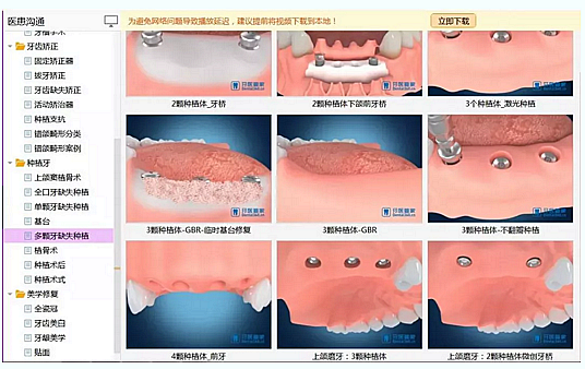 牙科普通前臺和優(yōu)秀前臺到底差在哪？