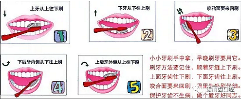 楔狀缺損是幾個(gè)意思 ?