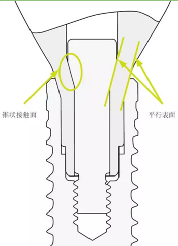 揭秘士卓曼種植體-基臺(tái)的長(zhǎng)期穩(wěn)定性