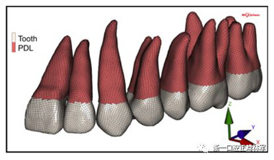 正畸文獻(xiàn)閱讀--對(duì)于滑動(dòng)法關(guān)閉間隙的有限元分析