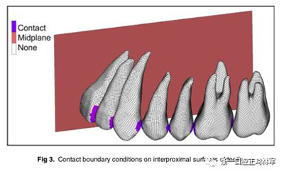 正畸文獻(xiàn)閱讀--對(duì)于滑動(dòng)法關(guān)閉間隙的有限元分析