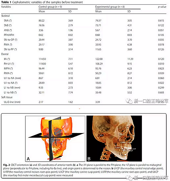 正畸文獻(xiàn)閱讀--用舌側(cè)滑動(dòng)牽引系統(tǒng)控制前牙區(qū)段：初步的CBCT研究