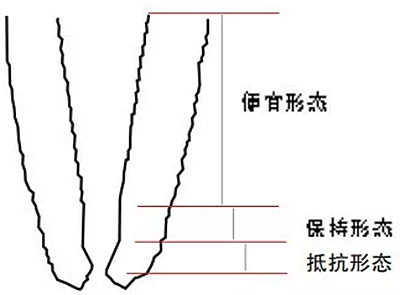 知識分享：規(guī)范化根管治療的細節(jié)分析