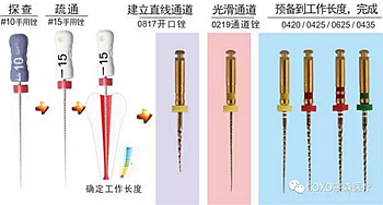 知識分享：根管治療的標(biāo)準(zhǔn)步驟