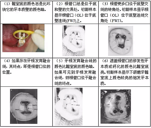 知識分享：根管治療的標(biāo)準(zhǔn)步驟