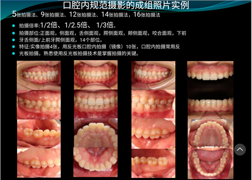 口內(nèi)照攝影方法與技巧分享