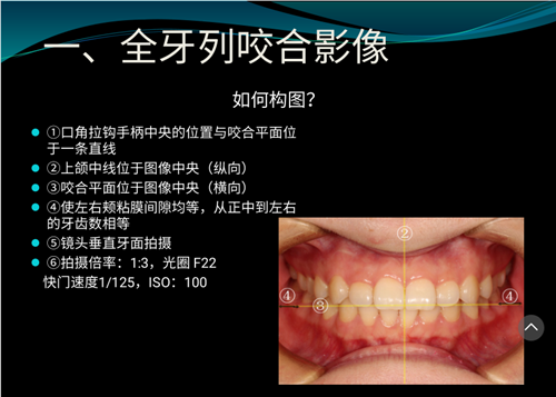 口內(nèi)照攝影方法與技巧分享