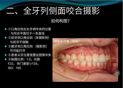 口內(nèi)照攝影方法與技巧分享