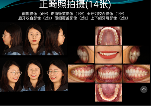 口內(nèi)照攝影方法與技巧分享