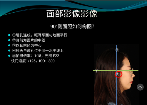 口內(nèi)照攝影方法與技巧分享