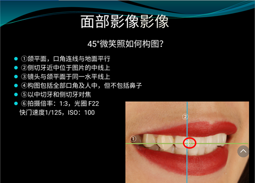 口內(nèi)照攝影方法與技巧分享