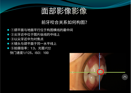 口內(nèi)照攝影方法與技巧分享