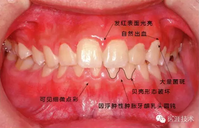 上海品瑞邁格磁致伸縮治療儀