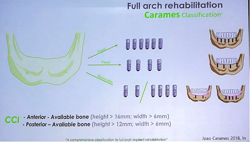 【熱點回顧】帶您深度了解無牙頜種植修復(fù)——Pro Arch