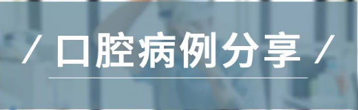 病例分享｜復(fù)合樹脂微創(chuàng)美學(xué)修復(fù)關(guān)閉上前牙間隙