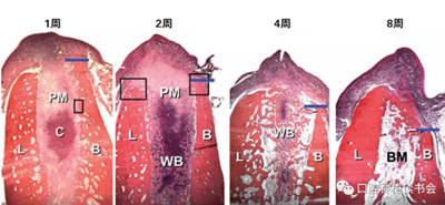 血液衍生物PRF&CGF在牙槽窩處理中的應(yīng)用