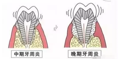 品瑞邁格磁致伸縮治療儀