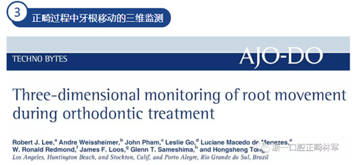 正畸文獻(xiàn)賞析--CBCT在正畸中的廣泛應(yīng)用