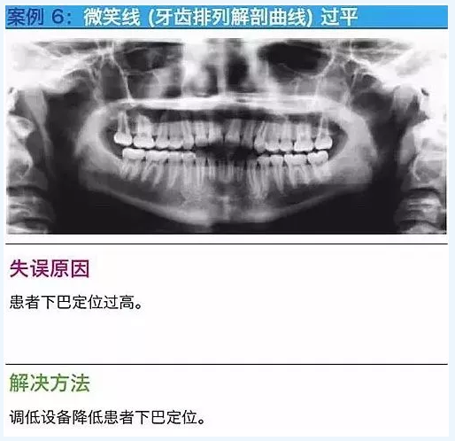 曲斷的10大經(jīng)典失誤案例及原因分析！