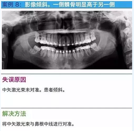 曲斷的10大經(jīng)典失誤案例及原因分析！