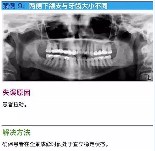 曲斷的10大經(jīng)典失誤案例及原因分析！