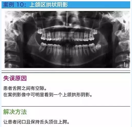 曲斷的10大經(jīng)典失誤案例及原因分析！