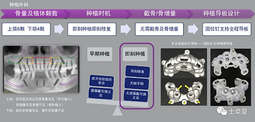 【病例分享】應用全程數(shù)字化對牙周炎患者實現(xiàn)全口即刻種植即刻修復