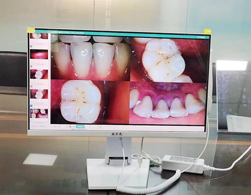美力光口腔觀(guān)察儀內(nèi)窺鏡